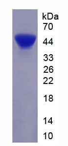 Recombinant Cytokeratin 18 (CK18)