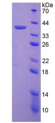 Recombinant Cytokeratin 18 (CK18)