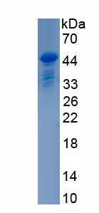 Recombinant Bactericidal/Permeability Increasing Protein (BPI)