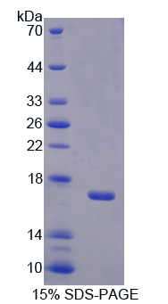 Recombinant Bactericidal/Permeability Increasing Protein (BPI)