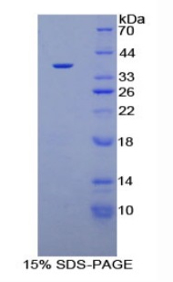 Recombinant Plasminogen (Plg)