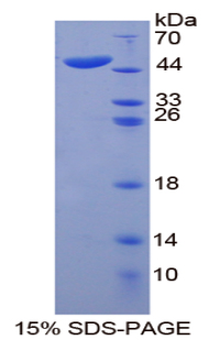 Recombinant Cytokeratin 20 (CK 20)