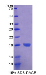 Recombinant Heart-type Fatty Acid Binding Protein (H-FABP)