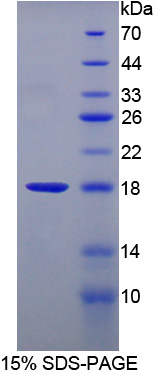 Recombinant Heart-type Fatty Acid Binding Protein (H-FABP)