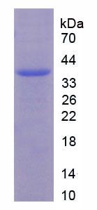 Recombinant Androgen Receptor (AR)