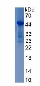 Recombinant Androgen Receptor (AR)
