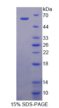 Recombinant Prolylcarboxypeptidase (PRCP)