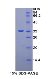 Recombinant Integrin Beta 3 (ITGb3)