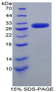 Recombinant Kininogen 1 (KNG1)