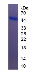 Recombinant Kininogen 1 (KNG1)