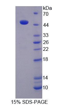 Recombinant Kininogen 1 (KNG1)