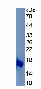 Recombinant Lipase, Hormone Sensitive (LIPE)