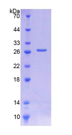 Recombinant Cathepsin D (CTSD)