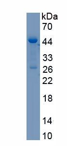 Recombinant Cathepsin D (CTSD)