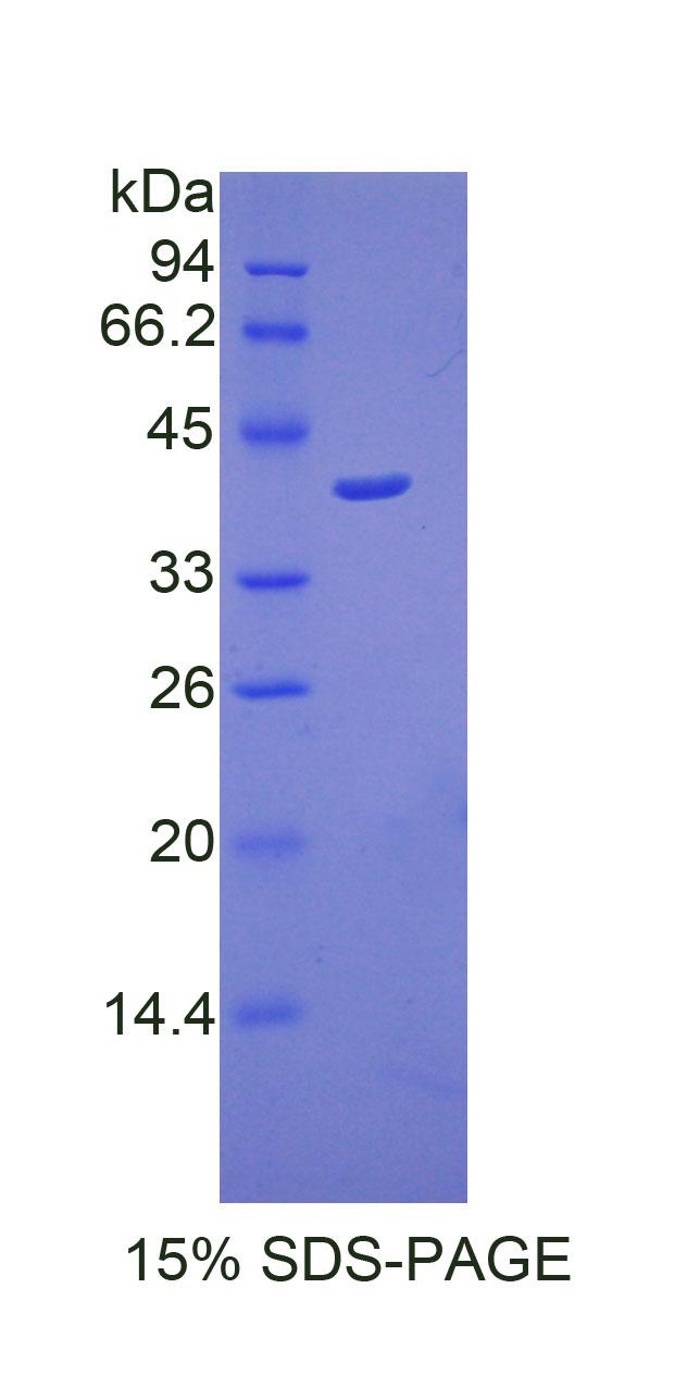 Recombinant Cathepsin D (CTSD)