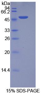 Recombinant Integrin Alpha 5 (ITGa5)