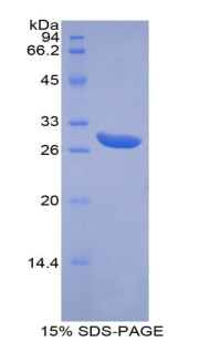 Recombinant ATP Binding Cassette Transporter G1 (ABCG1)