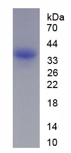 Recombinant V-Fos FBJ Murine Osteosarcoma Viral Oncogene Homolog (FOS)