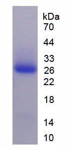 Recombinant Agrin (AGRN)