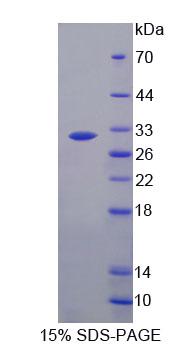 Recombinant Agrin (AGRN)