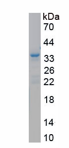 Recombinant Agrin (AGRN)