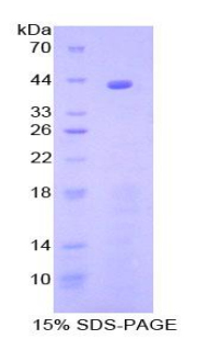 Recombinant Complement Component 8b (C8b)