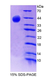 Recombinant Complement Component 8b (C8b)