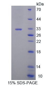 Recombinant Glutathione Reductase (GR)