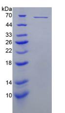 Recombinant Perforin 1 (PRF1)