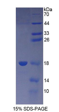 Recombinant Thymic Stromal Lymphopoietin (TSLP)