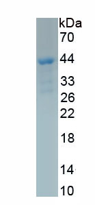 Recombinant Thymic Stromal Lymphopoietin (TSLP)