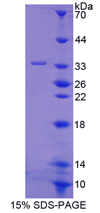 Recombinant Protein Tyrosine Phosphatase Receptor Type O (PTPRO)