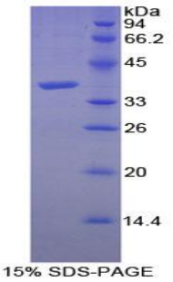 Recombinant Calcineurin (CaN)