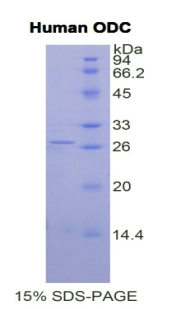 Recombinant Ornithine Decarboxylase (ODC)