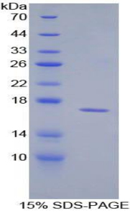 Recombinant Cluster of Differentiation 59 (CD59)