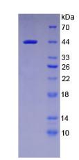 Recombinant Beta Actin (ACTB)
