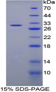 Recombinant Activating Transcription Factor 1 (ATF1)