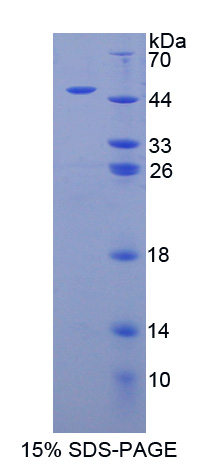 Recombinant Pituitary Adenylate Cyclase Activating Peptide (PACAP)
