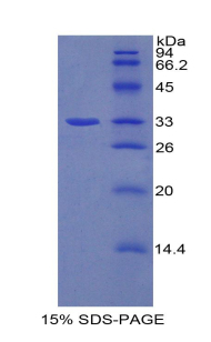 Recombinant Aryl Hydrocarbon Receptor (AhR)