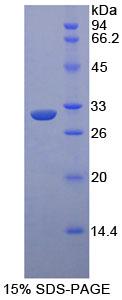 Recombinant Apoptosis Signal Regulating Kinase 1 (ASK1)