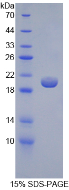 Recombinant Glucokinase Regulatory Protein (GKRP)