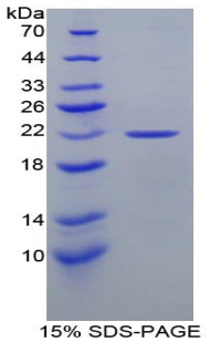 Recombinant Glucokinase Regulatory Protein (GKRP)