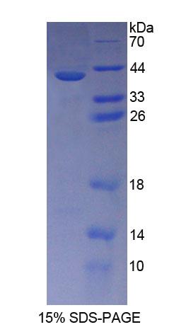 Recombinant Cadherin 5 (CDH5)