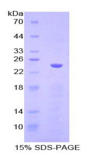 Recombinant Cadherin 5 (CDH5)