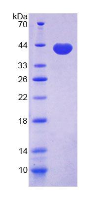 Recombinant Cadherin 5 (CDH5)