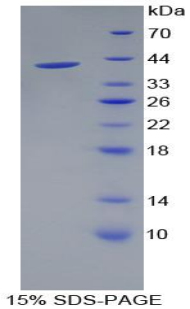 Recombinant Cadherin 5 (CDH5)