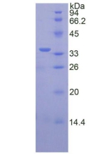 Recombinant Vascular Endothelial Growth Factor Receptor 2 (VEGFR2)