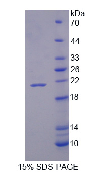 Recombinant Cluster Of Differentiation 74 (CD74)