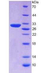 Recombinant Serpin B3 (SERPINB3)