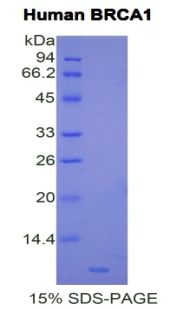 Recombinant Breast Cancer Susceptibility Protein 1 (BRCA1)